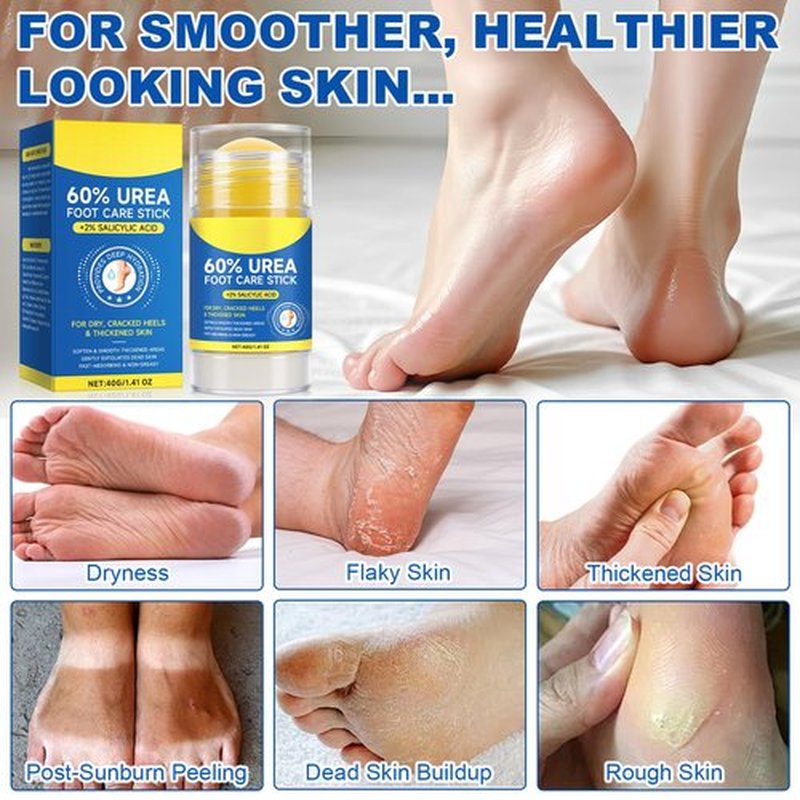 BQWSWWN Foot Cream for Dry Cracked Heels and Feet, 60% Urea with 2% Salicylic Acid Urea Foot Care Stick, Moisturizes and Hydrates the Dry Skin, Callus Remover Skin Softener, 1.41oz