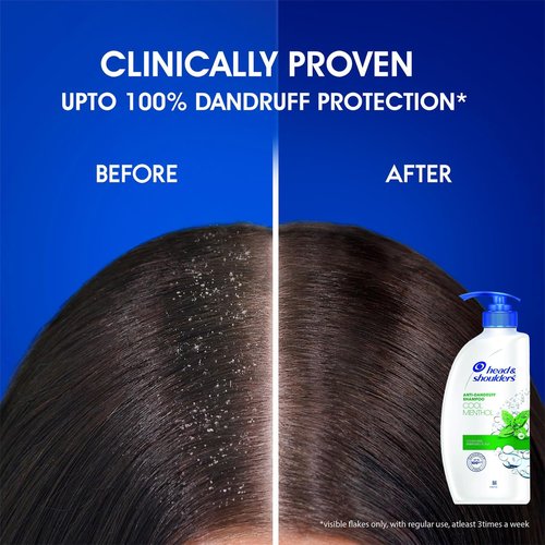 Head & Shoulders Anti Dandruff Shampoo, 2 Pack, Cool Menthol Scent Refreshes and Cleanses Scalp, Daily Use For all Hair Types, 22 oz Pump Bottles