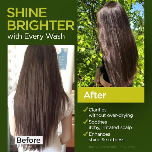 Tea Tree Rosemary Shampoo & Conditioner Set - Nourishing Cleanse with Castor Oil for All Hair Types | Paraben & Sulfate Free (16 Oz Each)
