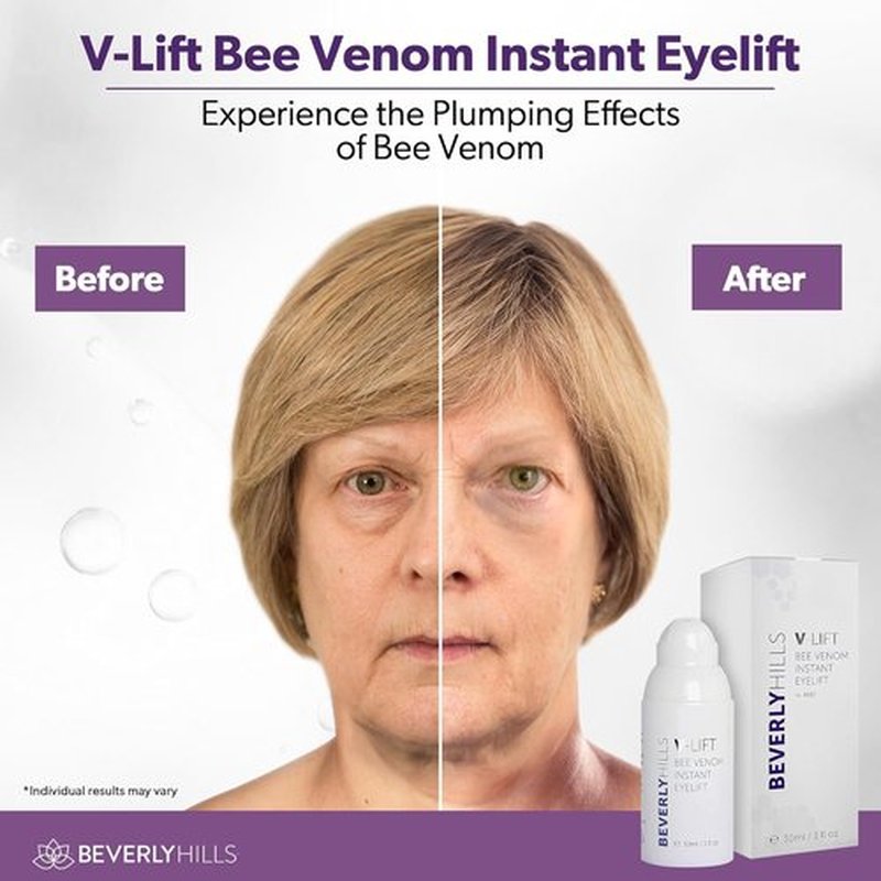 Beverly Hills V-Lift Eye Serum - Instant Eye Lift & Tuck with Bee Venom for Dark Circles | 30mL (120 Day Supply)
