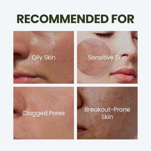 elravie HyCicaMue Defence Cream | Barrier Repair Moisturizer for Soothing, Recovery | Cica, Hyaluronic Acid, Vegan Mucin | Calming Sensitive Skin, Sebum Control, Boosting Hydration | Korean Skin Care