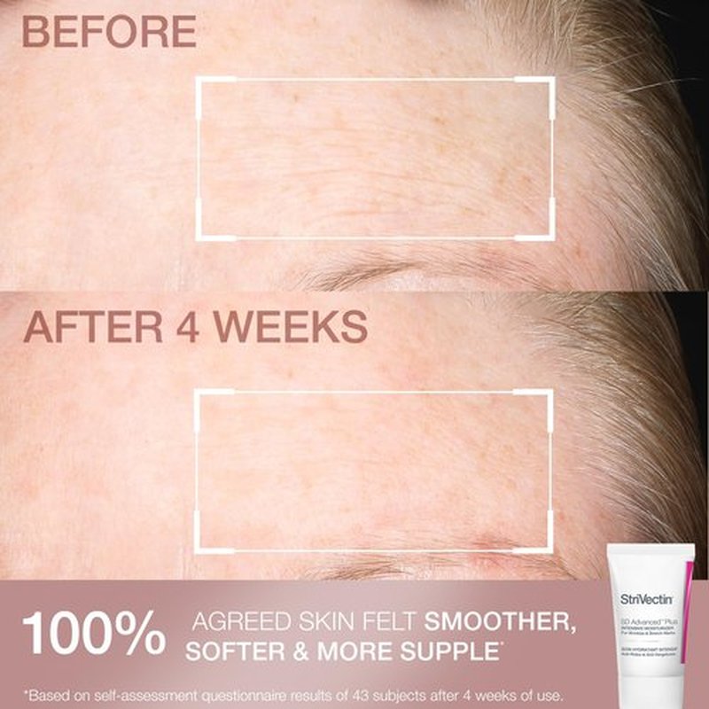 StriVectin Smooth & Hydrate Face Moisturizer and Eye Cream Skin Care 2-Piece Set