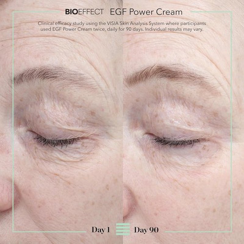 BIOEFFECT EGF Power Cream - Age-Defying Face & Neck Cream with Hyaluronic Acid & Niacinamide | 50 mL / 1.69 oz