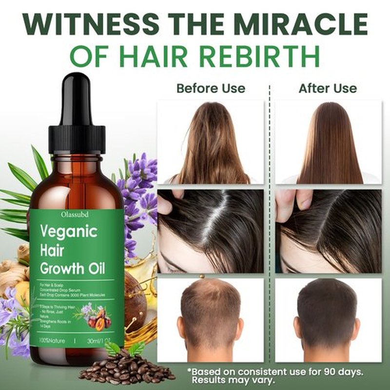 Hair Growth Oil with Rosemary Castor Oil Vegan Strengthening Formula for Thinning Hair Regrowth Treatment in Natural Vegan Hair Serum to Nourish Scalp Stimulate Follicles 3PCS for Man and Women