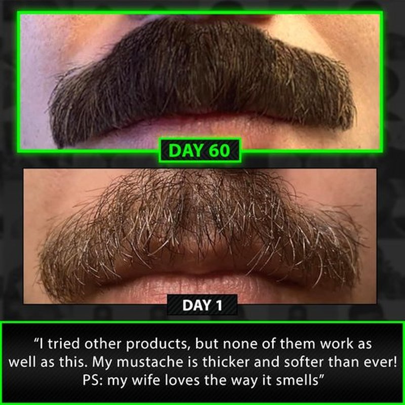 Beard Growth Kit - Skiennix Biotin Beard Balm & Conditioner + 6X Liquid Biotin for Thicker Hair