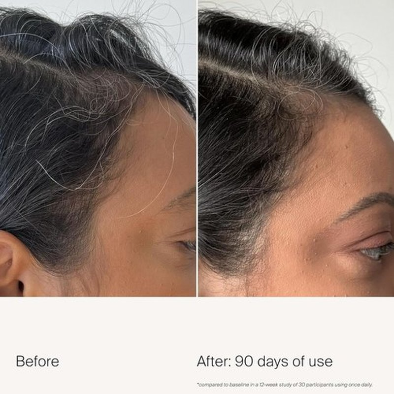 Living Proof Scalp Care Density Serum - Boost Hair Thickness & Nourish Scalp | 2 oz