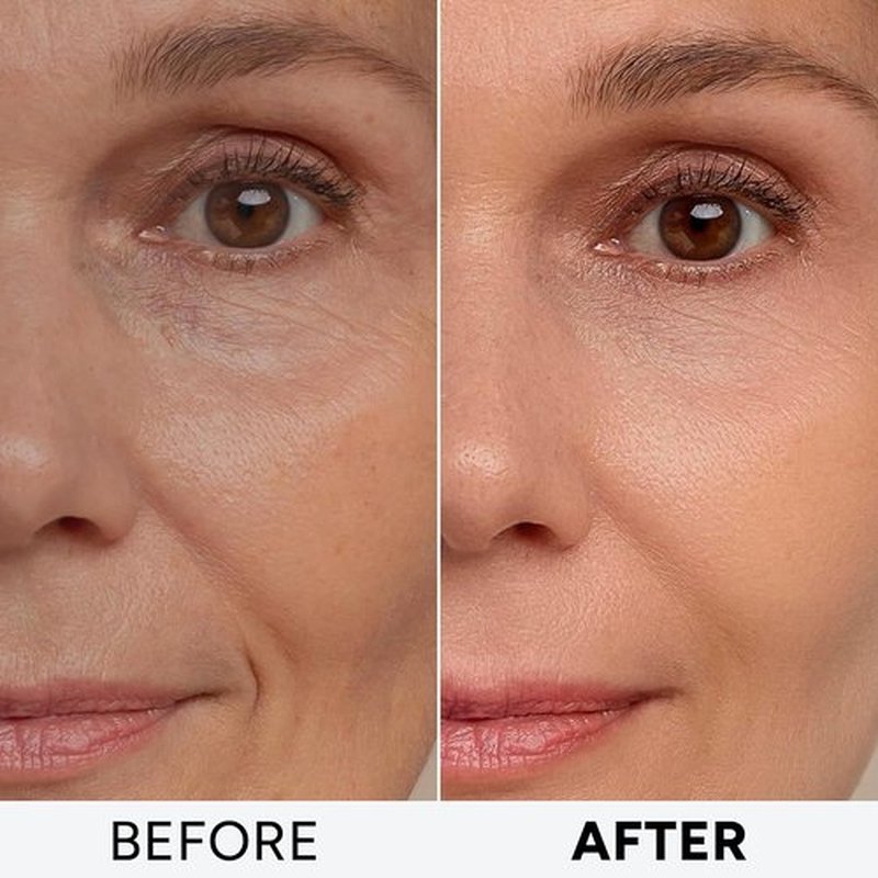 Regine Switzerland Retinol Cream - Anti-Aging Moisturizer with Collagen & Hyaluronic Acid | Day & Night Use for Firming Skin