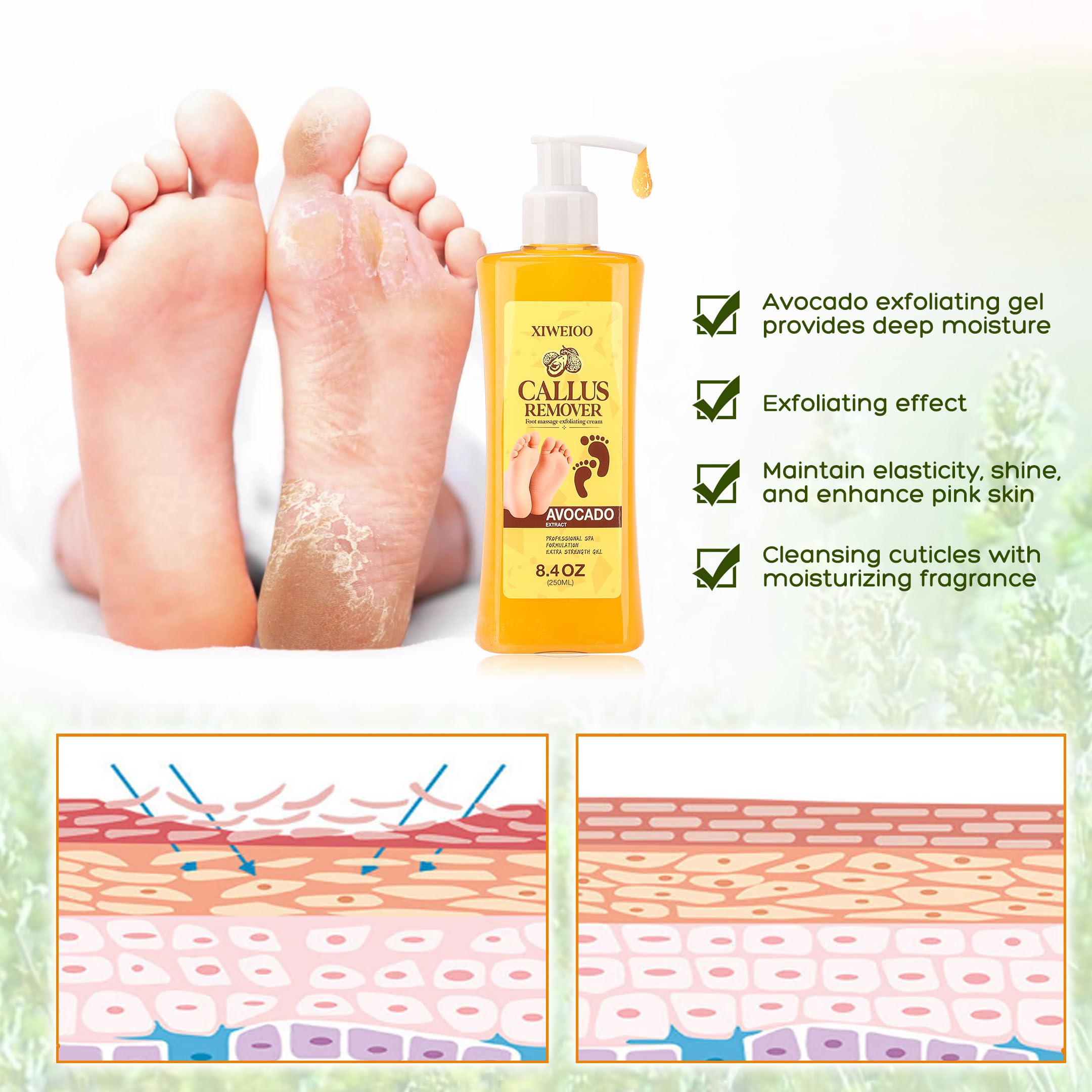 XIWEIOO Foot Callus Remover Gel Kit Heel Exfoliator Dead Skin Remover Pedicure Foot Spa Products Set Home Pedicure Foot Care Spa Supplies for Rough, Dry, Cracked Skin Cracked Heel, Professional