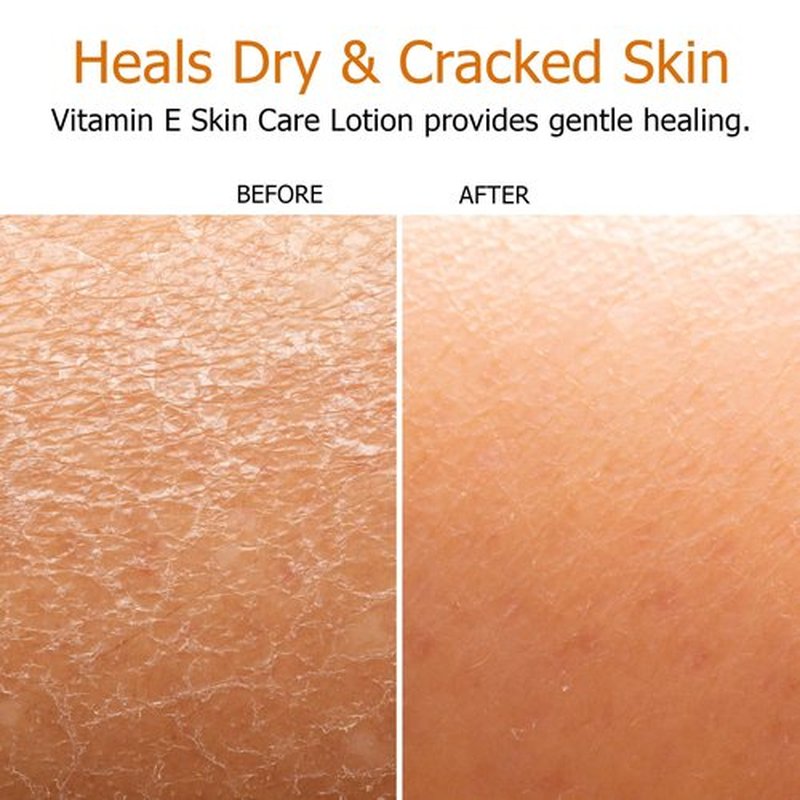 Fruit of the Earth Vitamin E Lotion 16 oz (2 Pack)