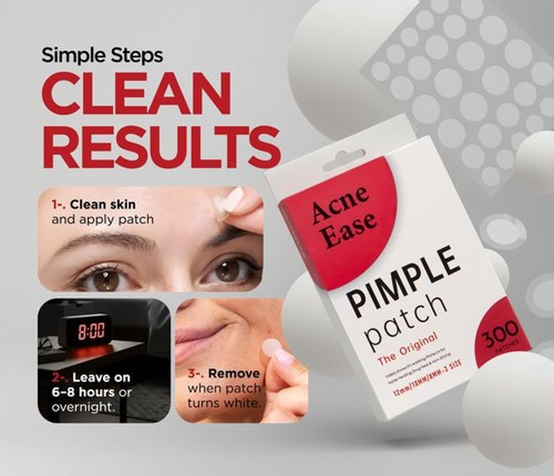 AcneEase Clear Pimple Patches with Ultra-Thin Hydrocolloid – 300 Cosmetic Zit Patches in 3 Sizes – Face Pimple Stickers for Daily Use