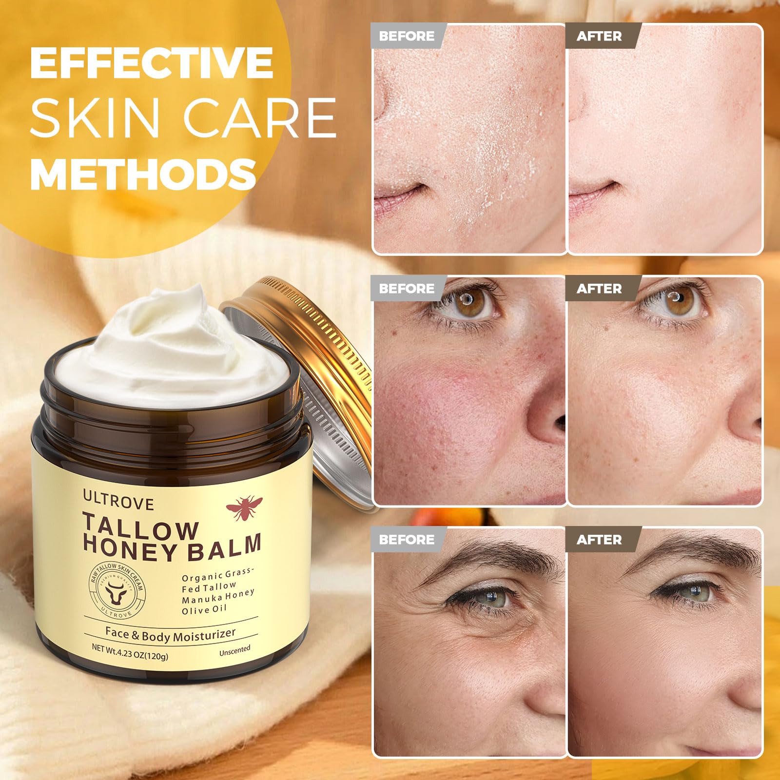 Ultrove Beef Tallow and Honey Balm for Skin, Natural Face + Body Moisturizer with Organic Grass-Fed Beef Tallow & Raw Wild Honey for Dry & Sensitive Skin, 4.23oz