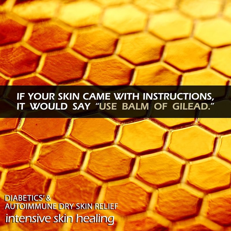 Balm of Gilead Therapeutic Rubbing Oil - Frankincense & Sweet Myrrh for Diabetic & Autoimmune Dry Skin Relief, 2 fl oz