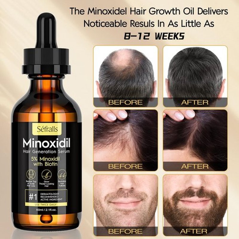 5% Minoxidil Hair Growth Oil for Men & Women Kit - Extra Strength Regrowth Serum, Topical Hair Loss Treatment Serum, Thicker, Healthier Hair & Beard Growth Kit, 2.11 fl.oz