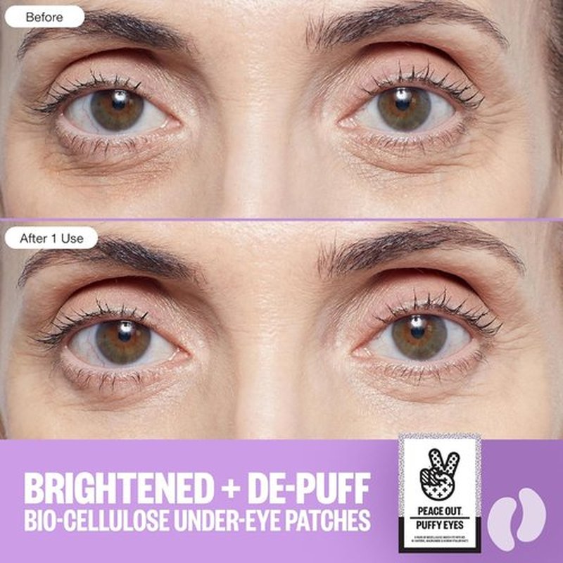 Peace Out Under Eye Patches - Biocellulose Mask with Caffeine & Niacinamide for Puffiness Relief | 6 Pairs