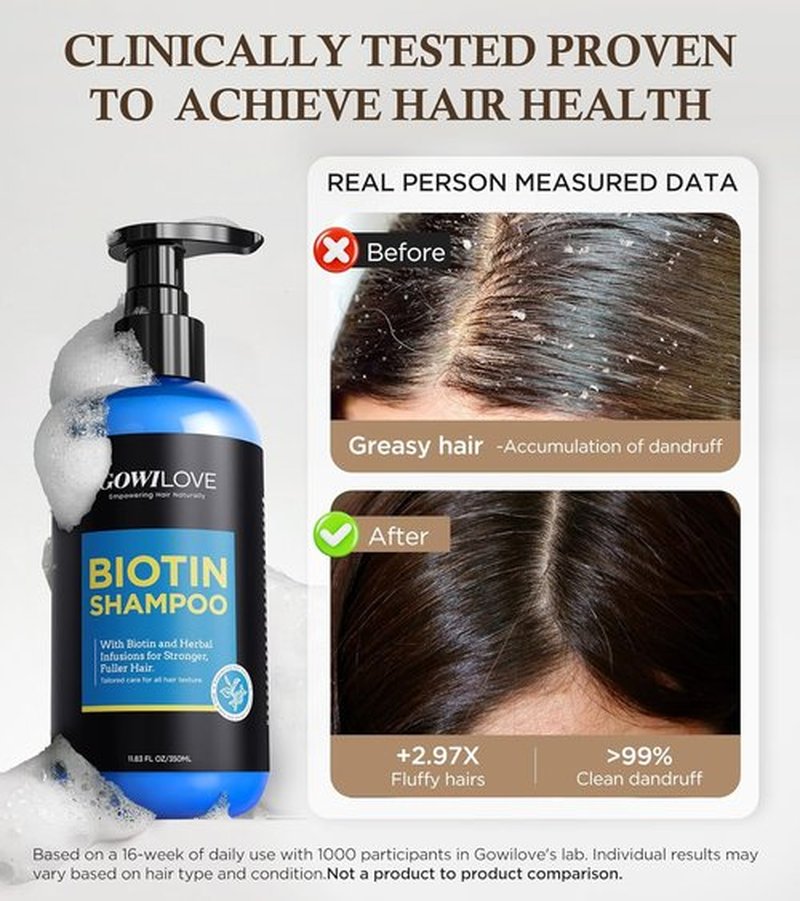 Skiennix 99% Pure Biotin Shampoo - 3X Thicker Hair Growth & 80% Less Hair Loss | 11.83oz Nourishing Treatment
