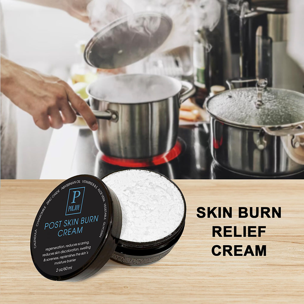 PolJoy Post Skin Burn Cream, Sunburn Cream for First Aid Treatment, Hydrates & Repairs Skin with Aloe Vera, Shea Butter, Zinc Oxide, Calendula, Coconut Oil & Vitamins B&E, Kitchen & Travel Use