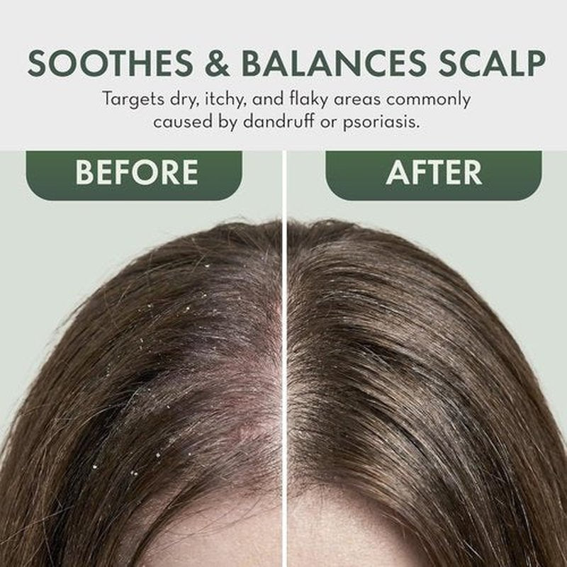 Regine Switzerland Leave-In Conditioner Spray - Tea Tree Scalp Treatment for Dandruff Relief | Hydrating Formula for Dry, Itchy Scalp