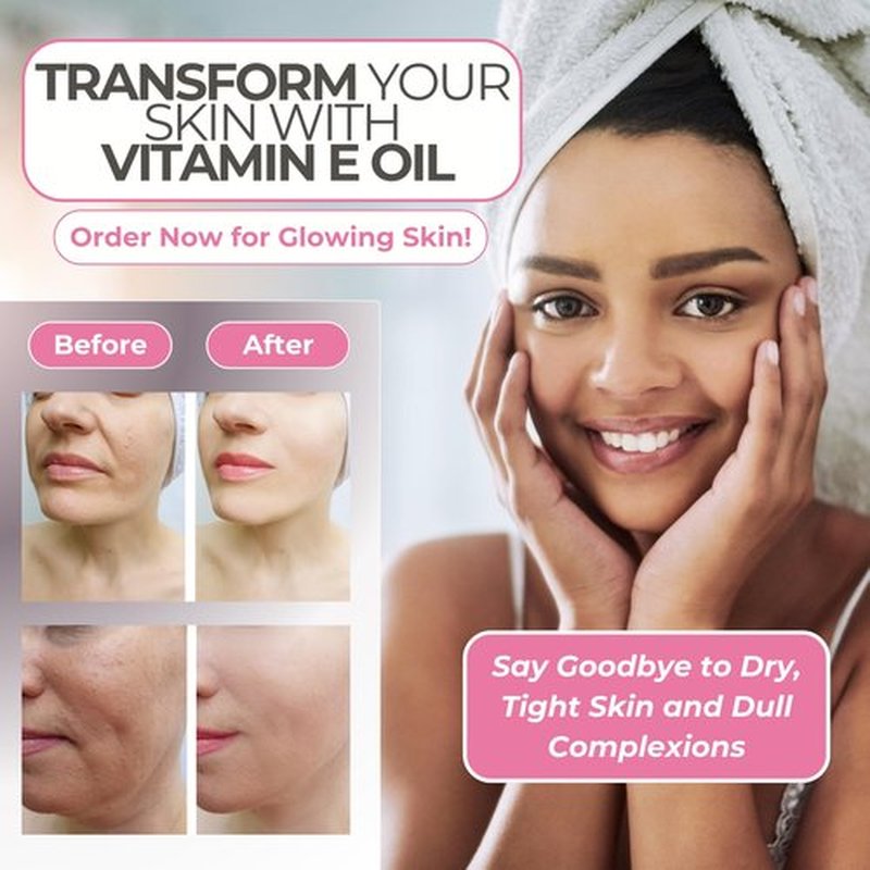 Leven Rose 100% Vitamin E Oil 75,000 IU per oz 100% Natural, Organic, Pure Vitamin E Oil for Skin, Face, Hair, Nails 1oz
