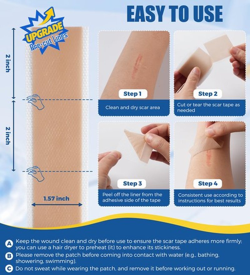 MasterMo Medical Grade Silicone Scar Sheets & Tape - 1.6”x120“ Roll, Ultra Soft, Hypoallergenic Rolls for Surgical, C-Section, Tummy Tuck, Keloid Scars, Stretch Marks & Burn Scar Removal