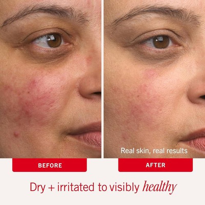 First Aid Beauty - Ultra Repair Cream - Hydrating Face & Body Moisturizer - Strengthens Skin Barrier in 7 Days | 6oz Plus 1oz Tube