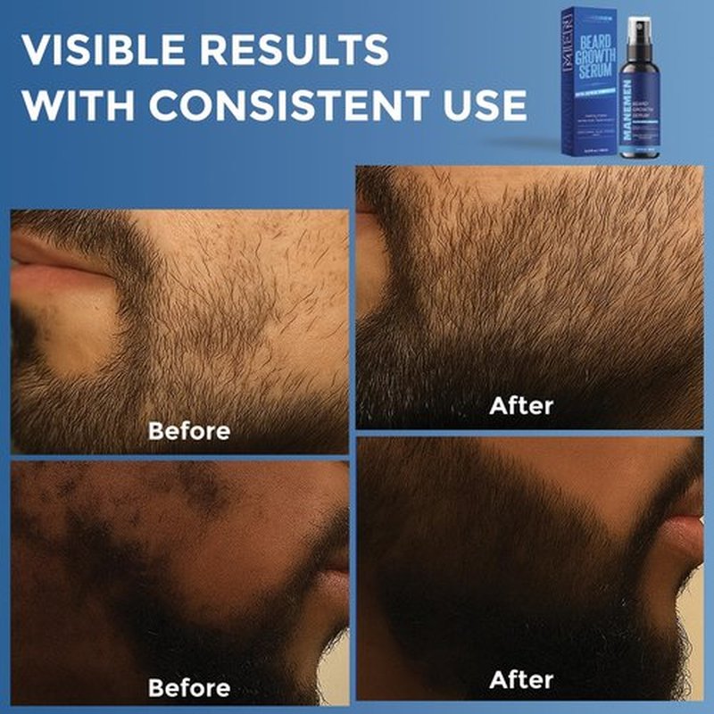 Manemen Beard Growth Serum Spray- Biotin, Castor Oil, Vitamin B5 & B12 - Natural Hair Regrowth Beard Oil Formula for Thicker, Fuller, Stronger Beard - Stimulates Hair Follicles & Supports Fast Growth
