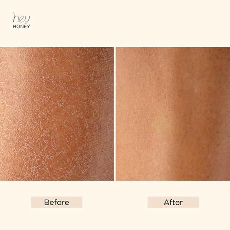 Hey Honey Skin Care Mango & Honey Water-Free Body Lotion - Hyaluronic Acid, Ceramides & Barrier Repair for Hands, Elbows & Dry Sensitive Skin | 24-Hr Hydration, Fruit Enzymes, Cruelty-Free | 6.7 oz
