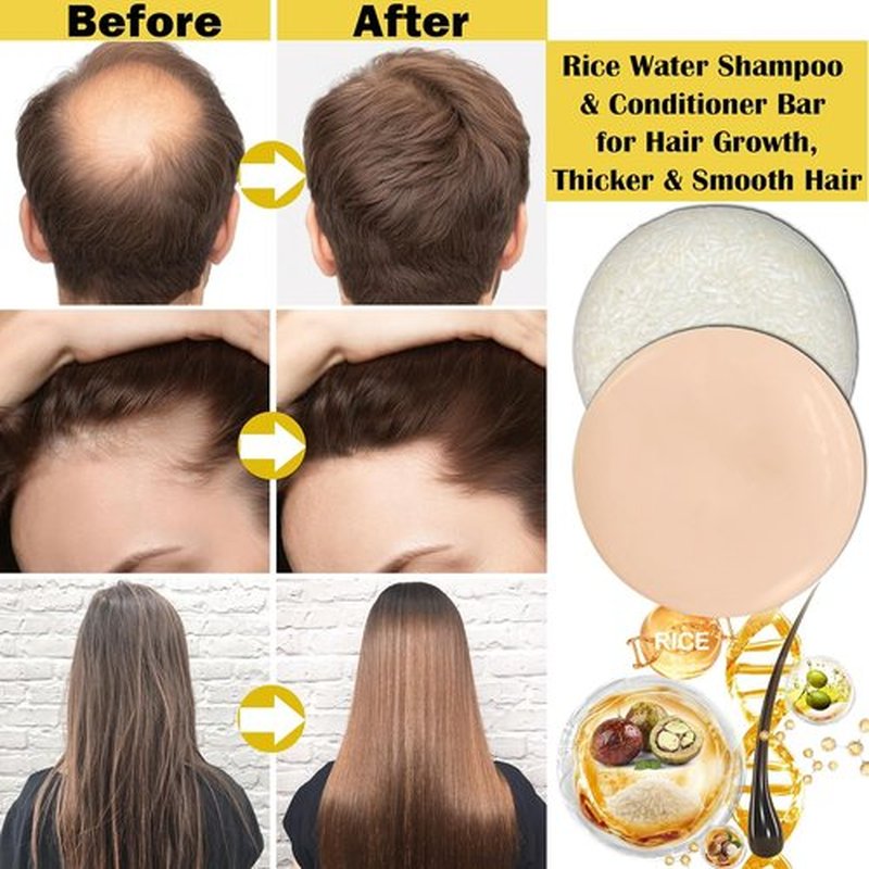 Skiennix Rice Water Shampoo & Conditioner Set - Organic Hair Growth Formula | Deep Cleansing & Strengthening, 2 Pack