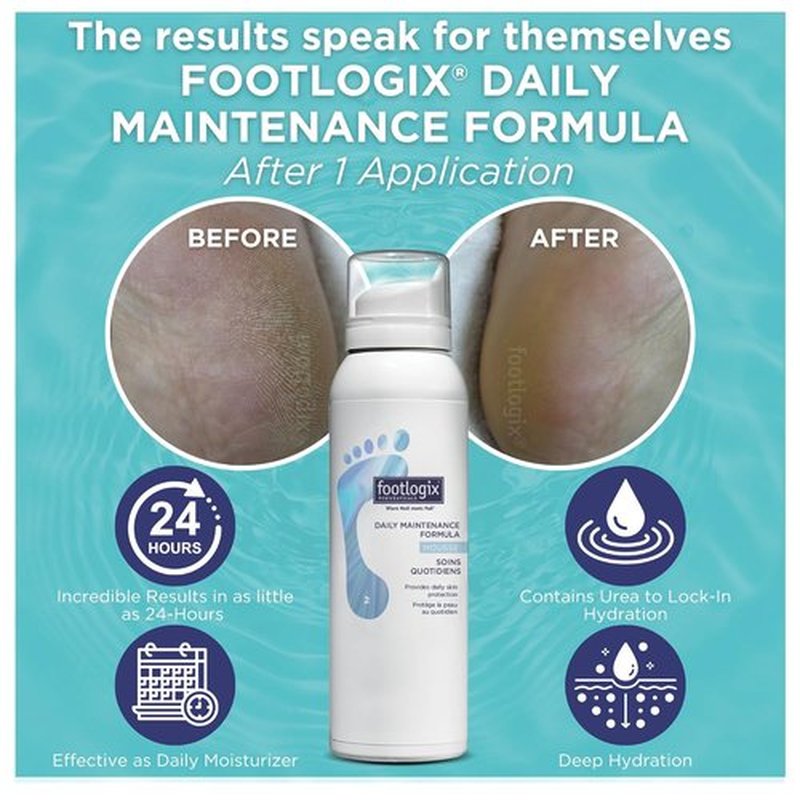 Footlogix Daily Maintenance Formula - Moisturizing Foot Mousse for Normal to Dry Skin | 4.23oz