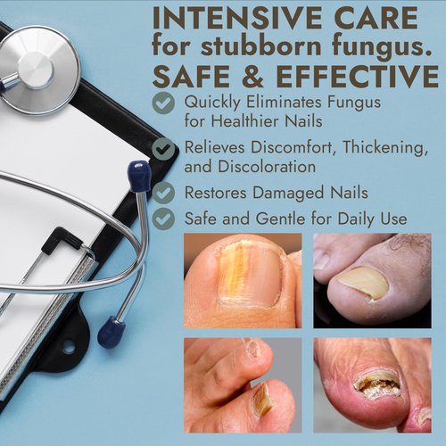 Terramed Just Think Comfort Toenail Fungus Antifungal Foot Cream, Antifungal Foot Treatment NDC Code(s): 83004-025