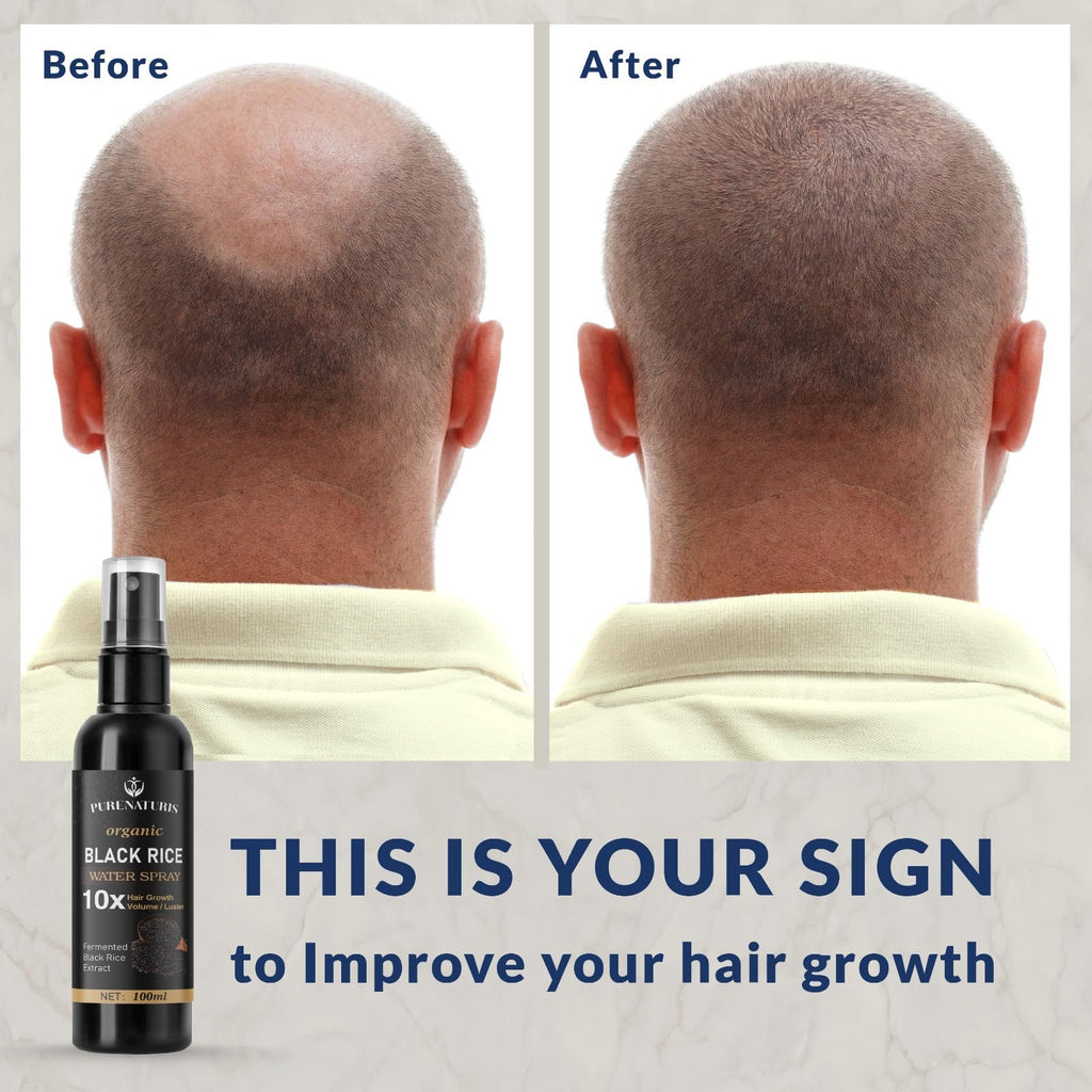 PureNaturis Castor oil Ginger Rice Water for Hair Growth Serum - Leave-In Spray for Men & Women, Effective for Hair Loss, Dry Damaged Hair, Hair Regrowth for Thicker, Fuller, Longer Hair, 3.5 fl oz