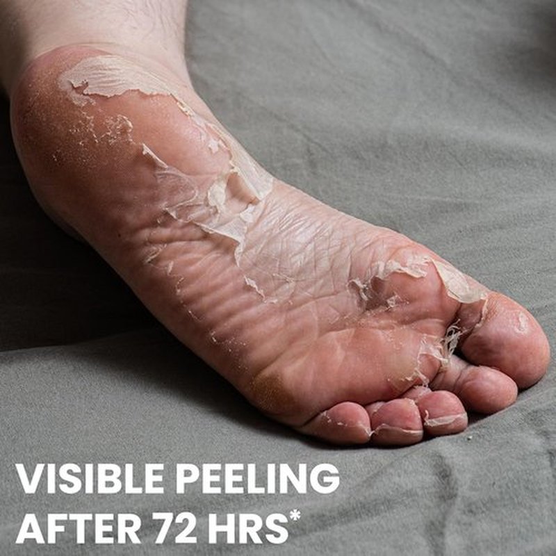 One's Own Korean Exfoliating Foot Peeling Mask, Moisturizing Foot Mask for Dry Cracked Feet, Feet Exfoliator to Peel Off Dead Skin & Callus Removal for Baby Soft Skin, Cruelty-Free & Safe, 1 Pair