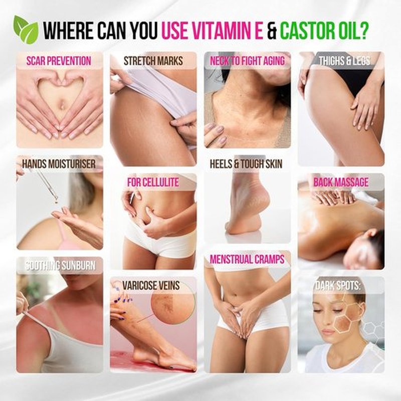 Skiennix Organic Vitamin E Oil - Scar & Stretch Mark Treatment with Castor, Rosehip, Jojoba - Hydrating Face & Body Oil