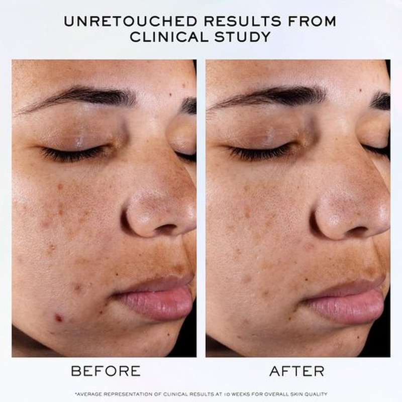 Lancôme Clarifique Pro-Solution Face Serum - Reduce Dark & Acne Spots with 10% PHA & Niacinamide