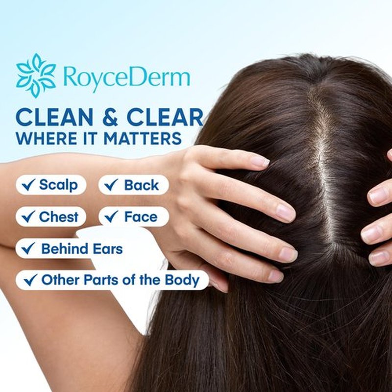 Roycederm Seborrheic & Psoriasis Calming Serum: Clinically Inspired Care for Itch, Dryness, Redness & Flaking - Seborrheic Dermatitis & Psoriasis Scalp Treatment Suitable for Scalp, Face & Body