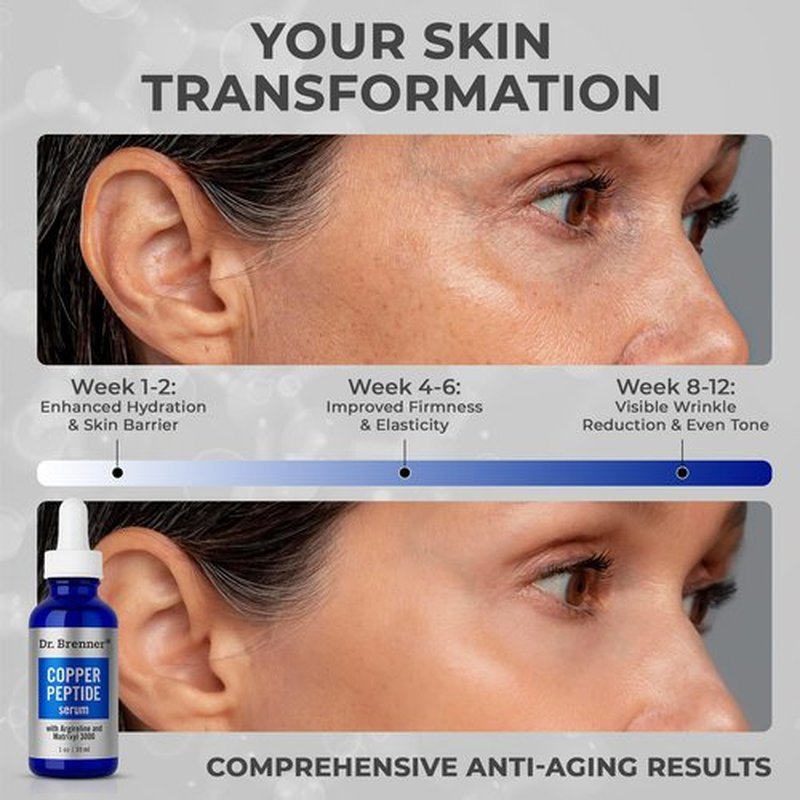 Dr. Brenner Copper Peptide Serum with GHK-Cu peptide, Argireline and Matrixyl 3000 Anti-Aging Moisturizer for Fine Lines and Skin Elasticity (1 oz.)