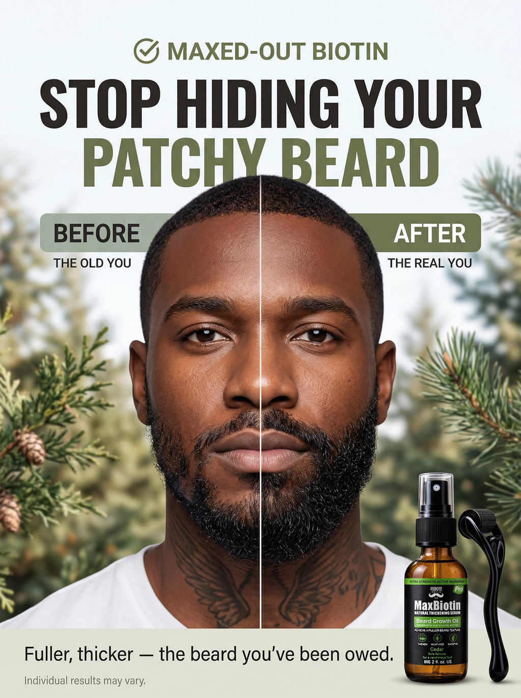 FEBOTE Patchy Beard Growth Kit for Men - Thickening Spray with Biotin & Castor Oil + Derma Roller - Cedar Beard Serum for Thicker Fuller Facial Hair - Natural Grooming Gift Set for Him