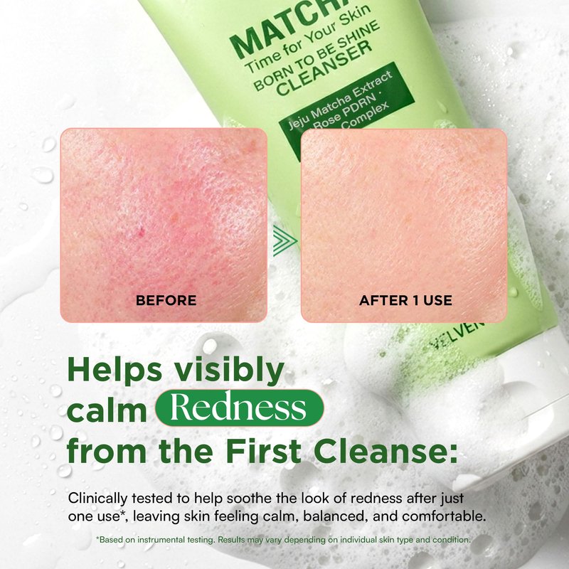 VELVENTE Matcha Gentle Deep Pore Cleansing Facial Cleanser, Low-pH Face Wash for Pore Refining, Rose PDRN Hydrating Daily Facial Wash Redness & Sensitive Skin Friendly, Korean Skincare(5.07 fl.oz.)