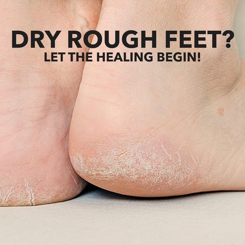 Adamia Therapeutic Foot Cream - Repairing Formula with Pure Macadamia Oil, 4 Oz | Fragrance-Free & Paraben-Free