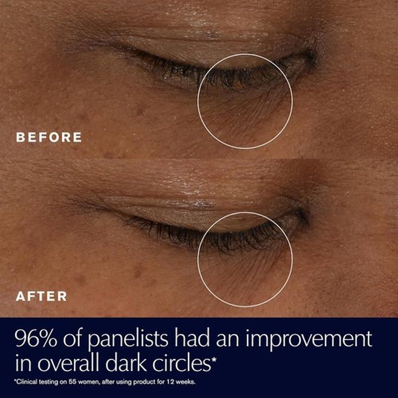Estée Lauder Advanced Night Repair Eye Gel-Cream - Supercharged Multi-Recovery for Dark Circles