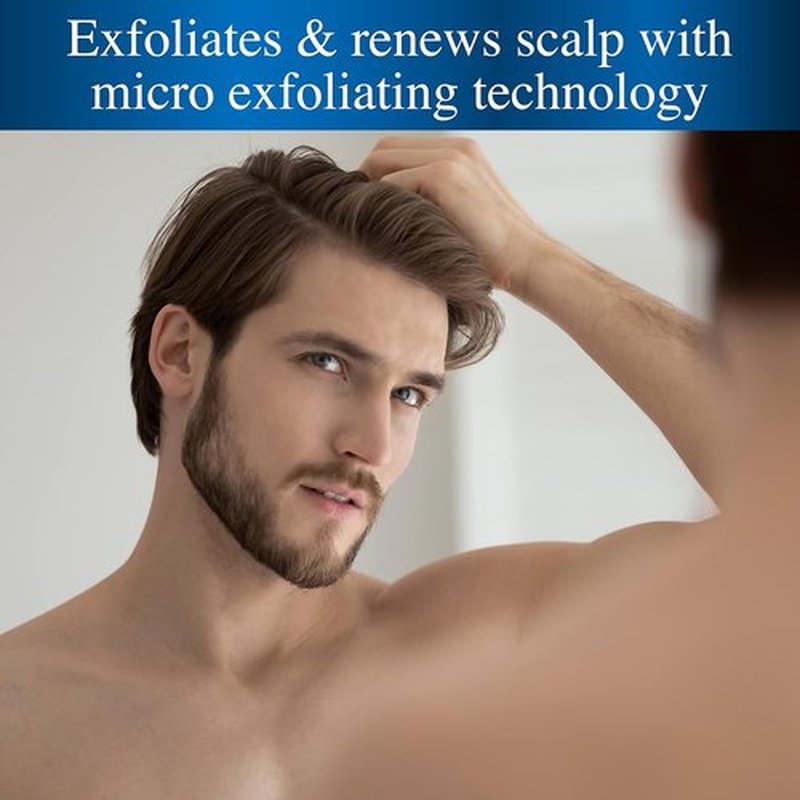Nizoral Pre-Shampoo Scalp Build-Up Remover - Exfoliates & Renews for Dandruff Treatment | 5 oz