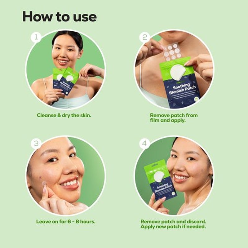 HANHOO Soothing Blemish Patch with Aloe, Madecassic Acid, and Tea Tree Extract | Hydrocolloid Spot Treatment | Calms Pre-stage, Irritated, and Popped Blemishes 216 count