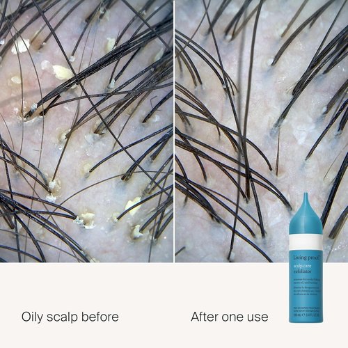 Living Proof Scalp Care Exfoliator - Revitalize Your Scalp for Healthier Hair