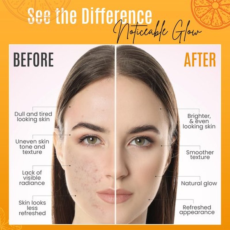 30% Vitamin C Serum (8 Fl Oz) Pure Organic Anti- Wrinkle + Hyaluronic Acid + Retinol + Vitamin E + Vitamin B, Facial Serum For Anti-aging, Wrinkles, And Fine Lines.