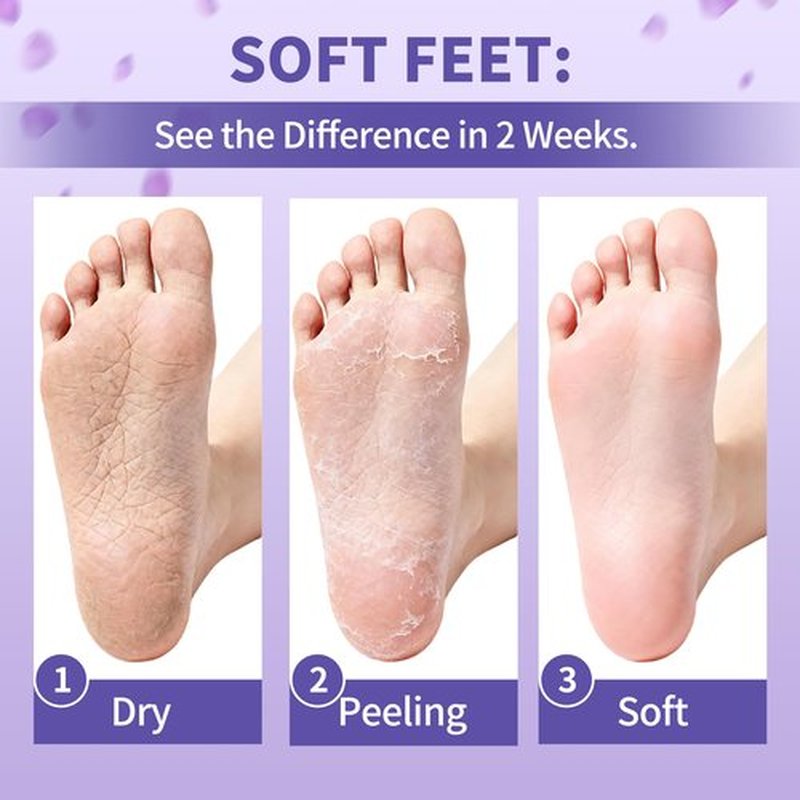 Foot Peeling Mask 5 Pairs - Foot Mask for Dry Cracked Feet, Feet Peeling Masks that Remove Dead Skin for Soft Heels (Lavender)