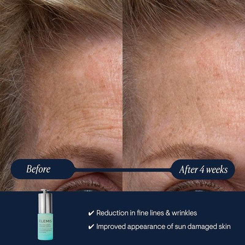 ELEMIS Pro-Collagen Renewal Serum - Gentle Retinol Alternative for Smoother Skin | 15ml