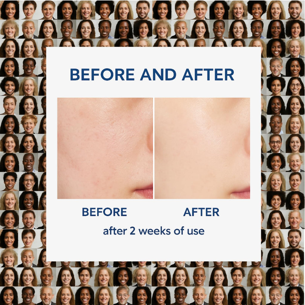 Dr Alpha Skin Barrier Cream 80ml, Moisturizing for Dry, Sensitive Skin, Face Care Lotion, Rejuvenating Face, Body, Legs