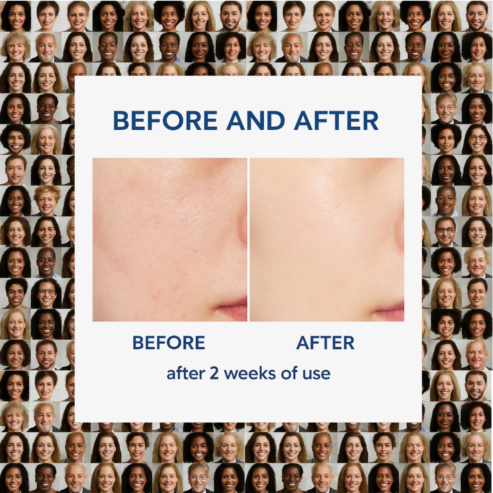 Dr Alpha Skin Barrier Cream 80ml, Moisturizing for Dry, Sensitive Skin, Face Care Lotion, Rejuvenating Face, Body, Legs