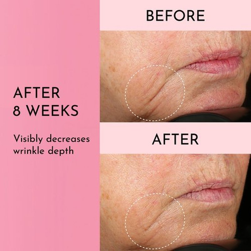 Lawless Mini Forget the Filler Skin-Plumping Line-Smoothing Perfecting Cream - Premium Non-Acne Moisturizer Designed to Prime, Plump, Smooth, and Tighten Skin for a Youthful, Hydrating Look - 0.5 oz