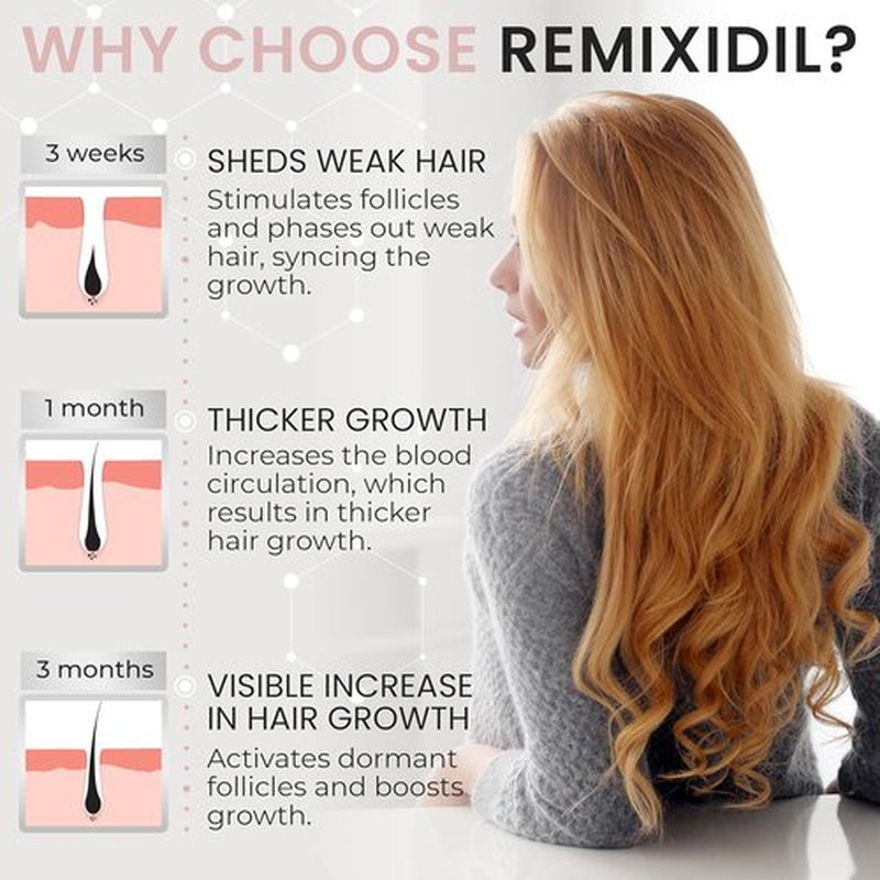Minoxidil 2% Hair Regrowth Spray for Women - Clinically Proven Thicker & Fuller Solution | 60 ml