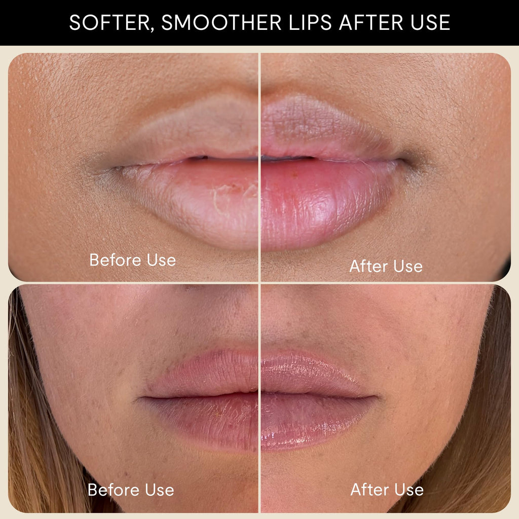 Silly George Lip Balm Recovery - Hydrating Overnight Mask for Dry Lips, Plush Replenisher with Shea Butter, Squalane & Vitamins, 10g